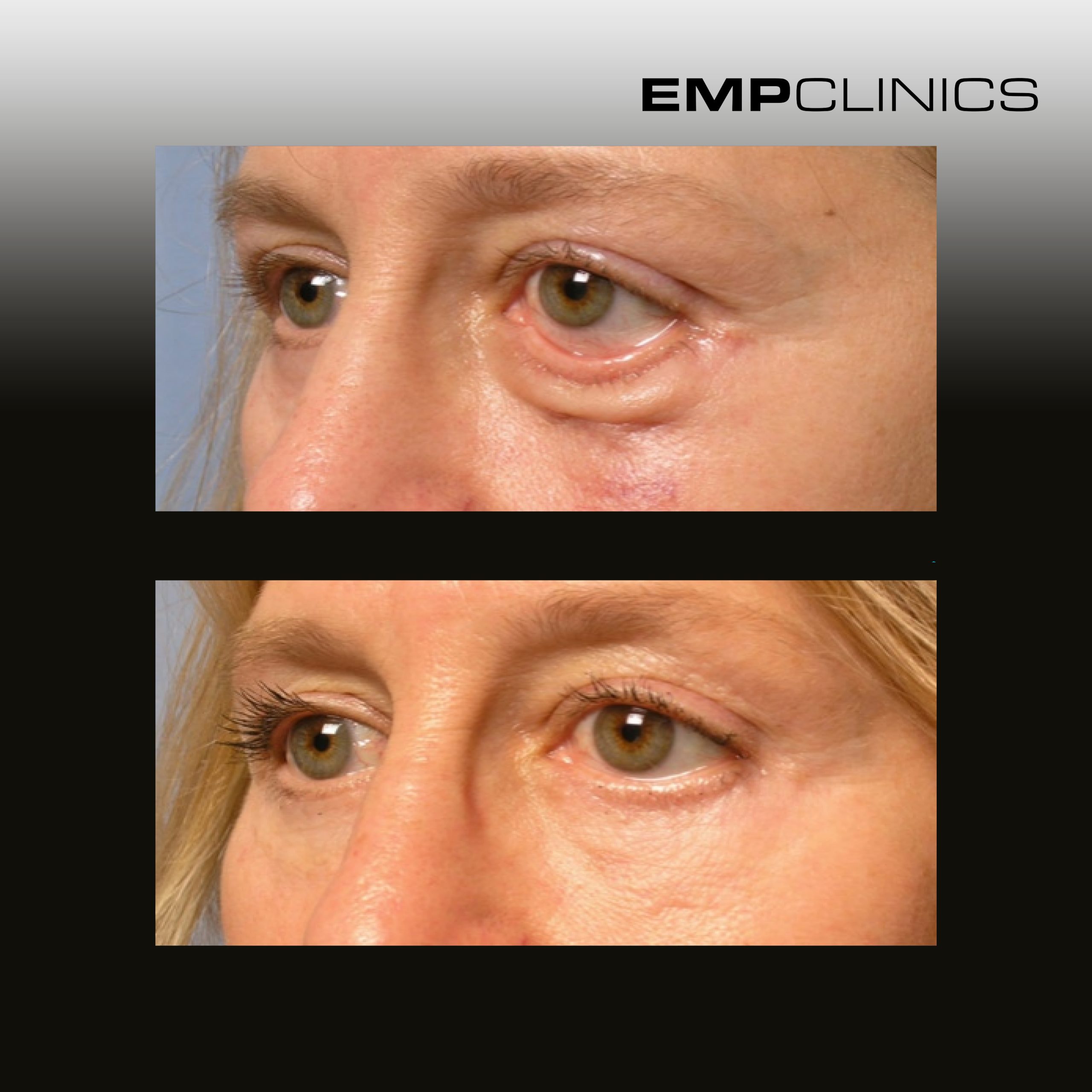 empclinics before after