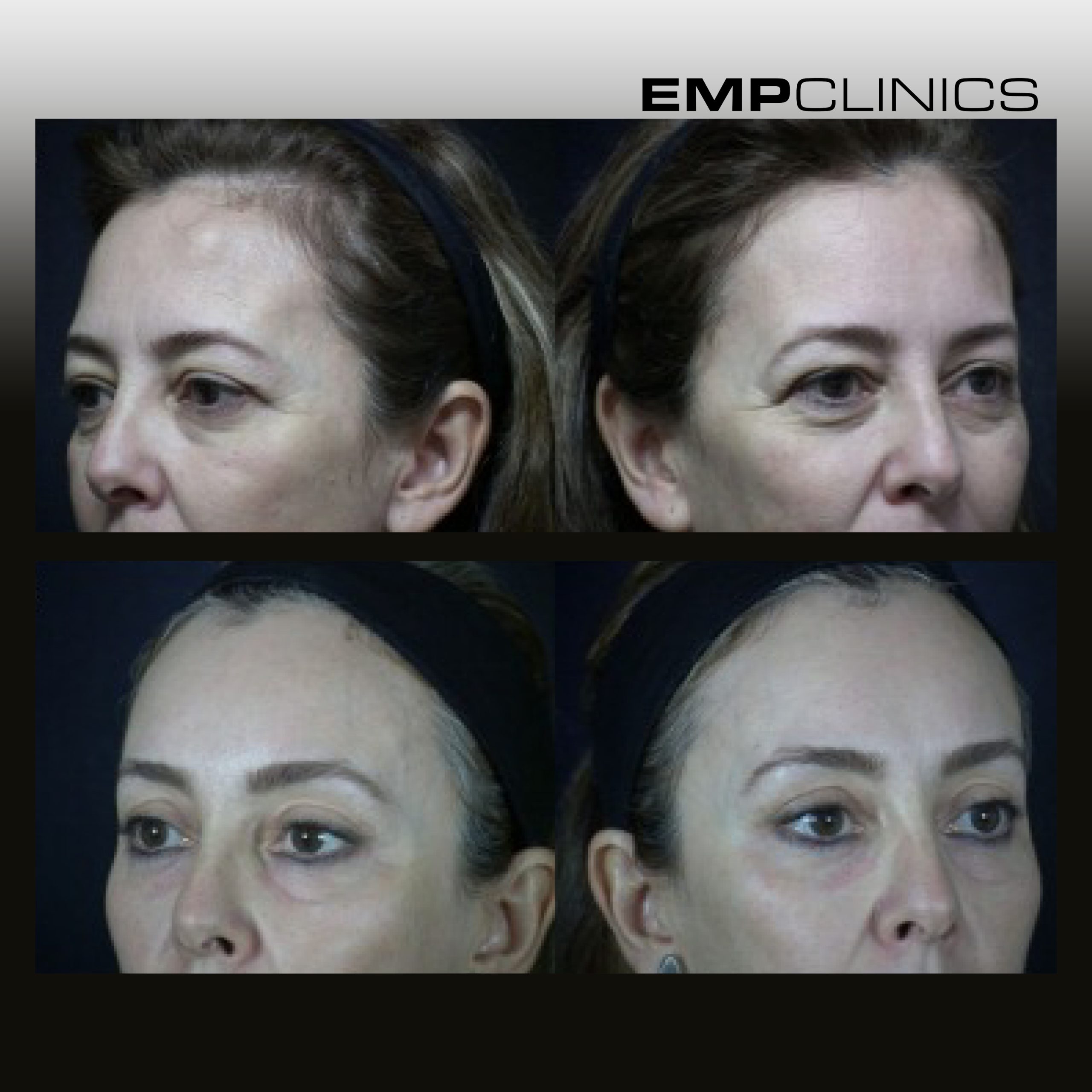 empclinics before after