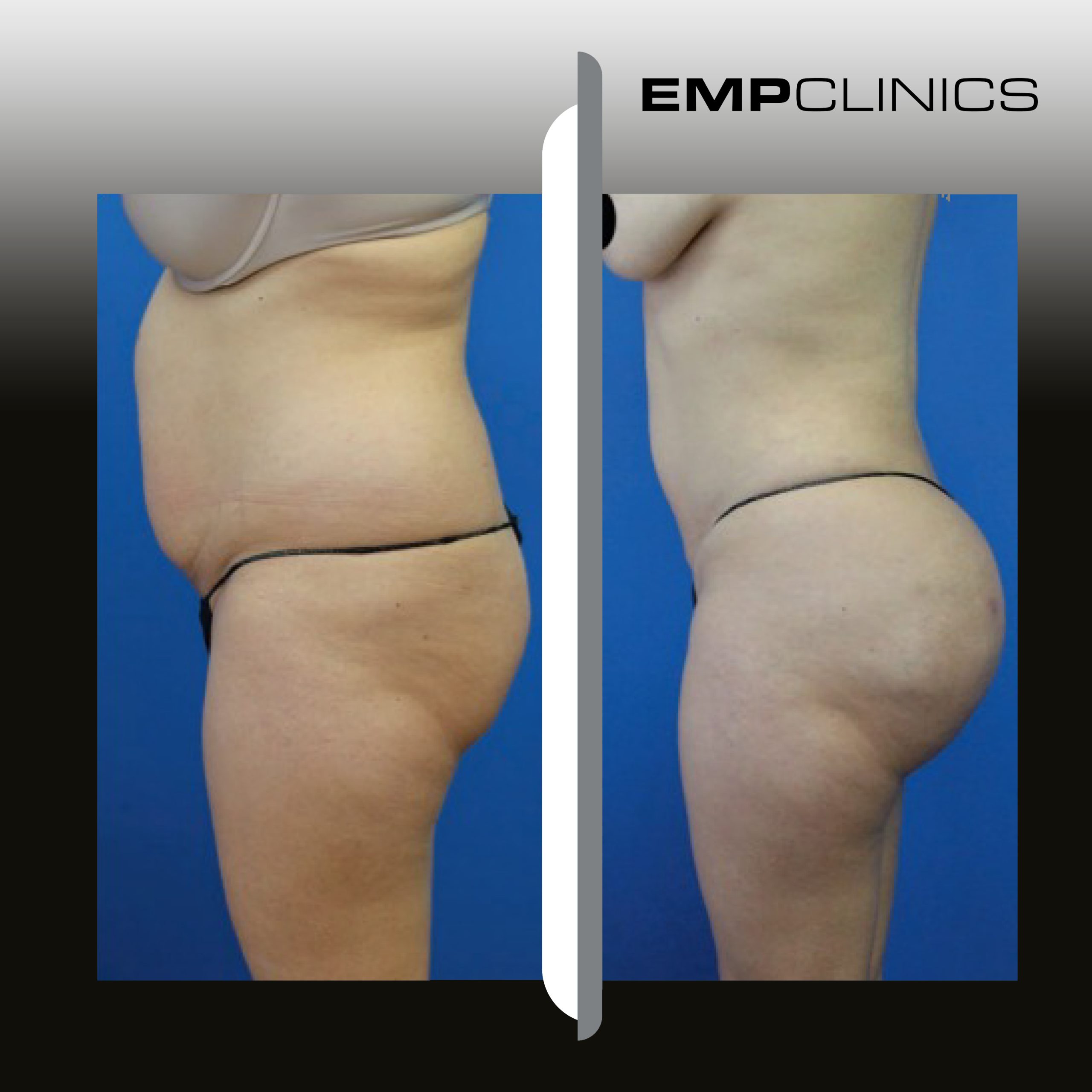 empclinics before after