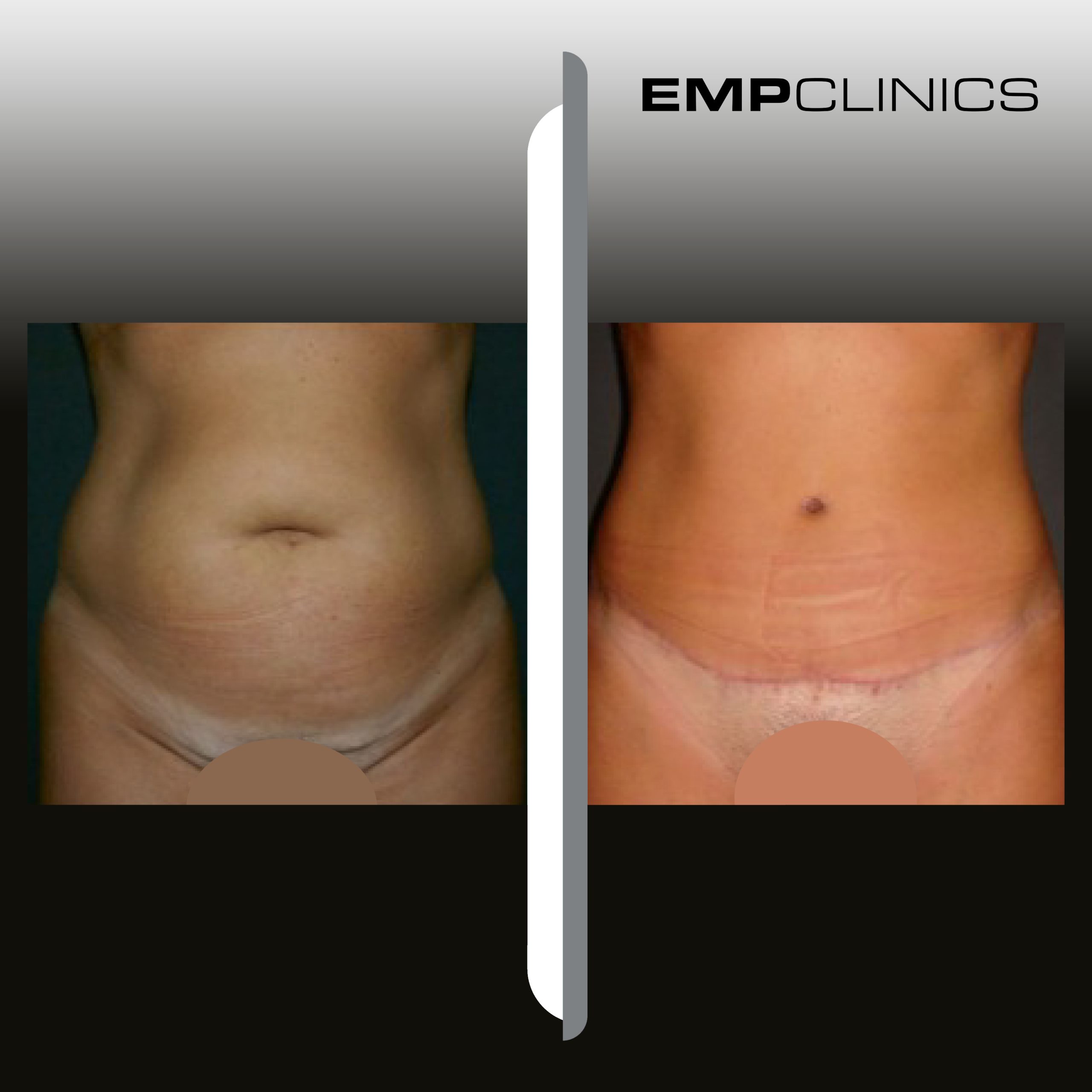 empclinics before after