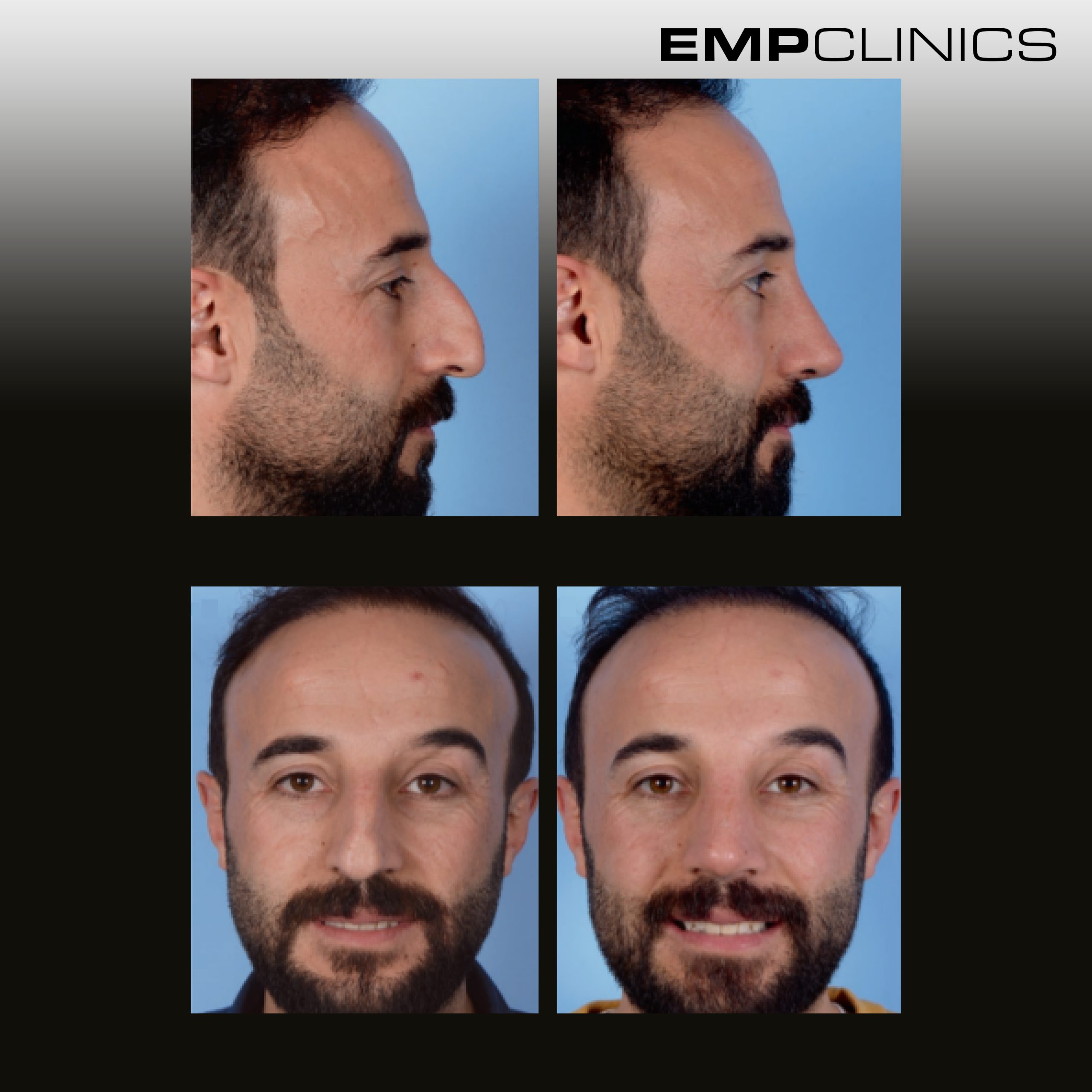 empclinics before after